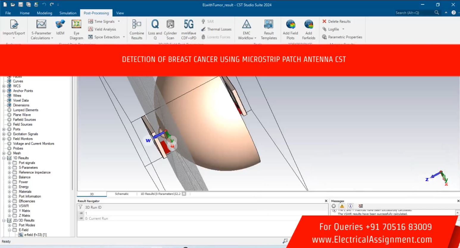 Design and implementation of flexible wearable antenna on thyroid gland in the detection of cancer cells screenshot 8